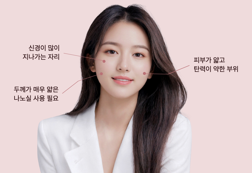 신경이 많이 지나가는 자리, 두께가 매우 얇은 나노실 사용 필요, 피부가 얇고 탄력이 약한 부위가 표시된 모델 사진