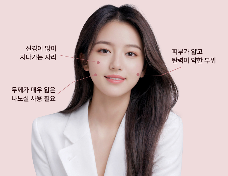 신경이 많이 지나가는 자리, 두께가 매우 얇은 나노실 사용 필요, 피부가 얇고 탄력이 약한 부위가 표시된 모델 사진