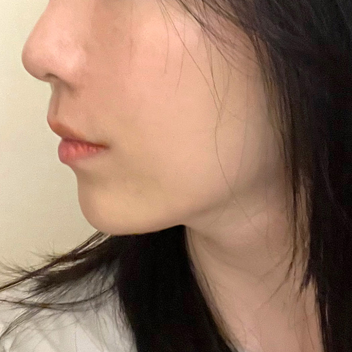 AFTER 03