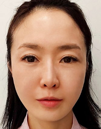 극진리프팅 AI 결과 예측 사진