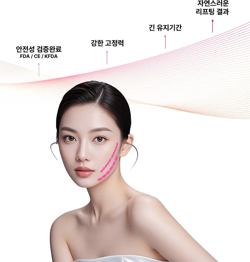 안전성 검증완료 FDA / CE / KFDA, 강한 고정력, 긴 유지시간, 자연스러운 리프팅 결과