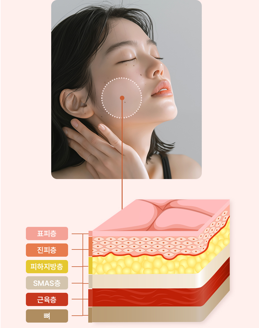 표피층, 진피층, 피하지방층, SMAS층, 근육층, 뼈를 나타내는 사진 + 모델사진